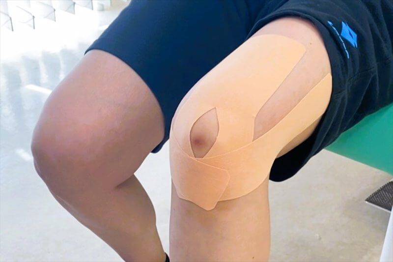 膝の水を抱える膝にテーピングを貼り前側の負担を分散している様子