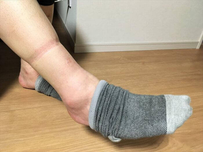 くっきり残った靴下跡が見える足首